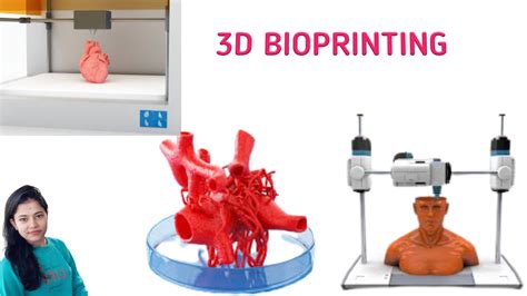 3D bioprinting .